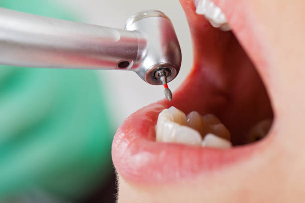 Best Dentist for Dental Trauma  in Woonsocket, RI